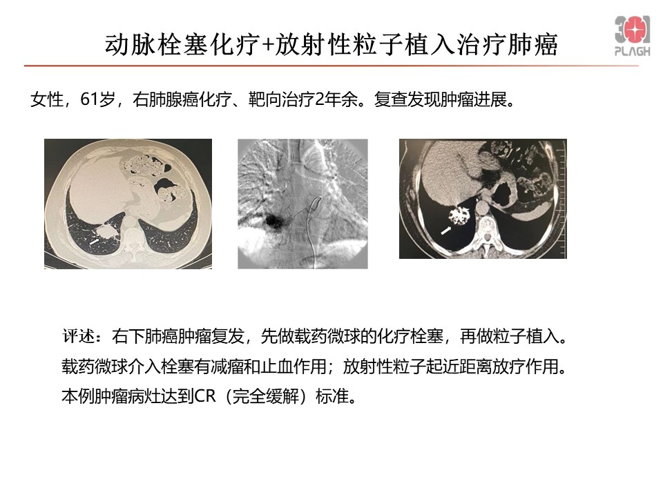幻灯片1.JPG