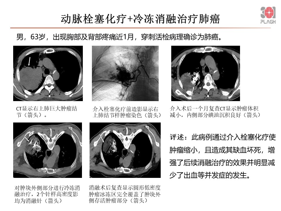 幻灯片2.JPG