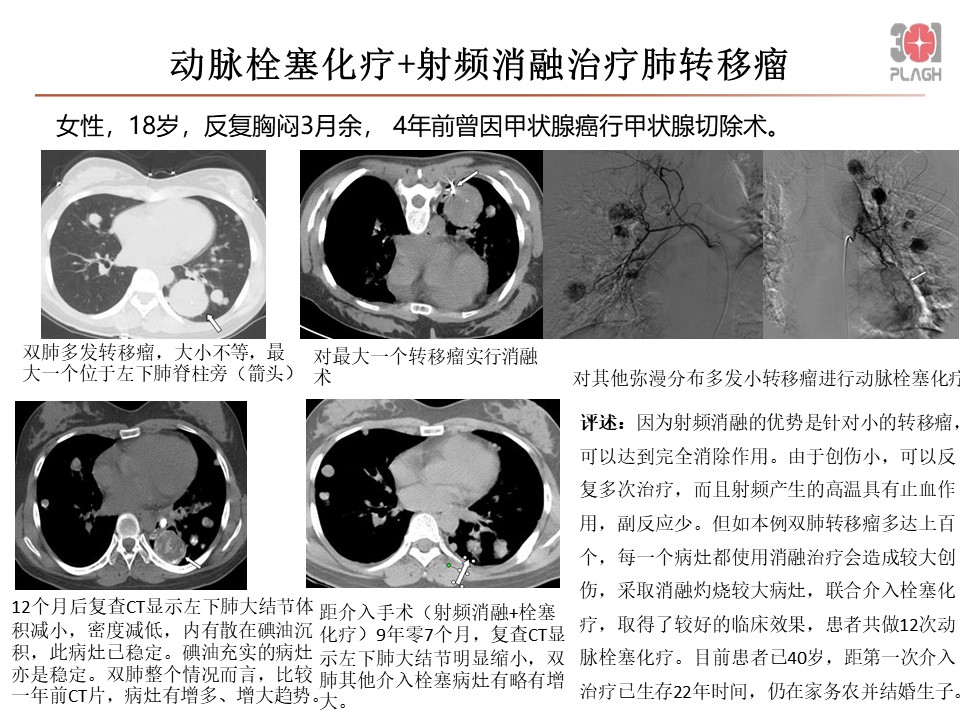 幻灯片3.JPG