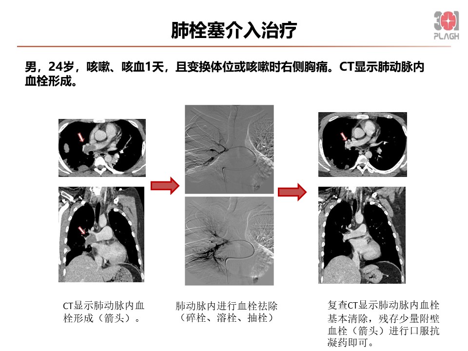 幻灯片4.JPG