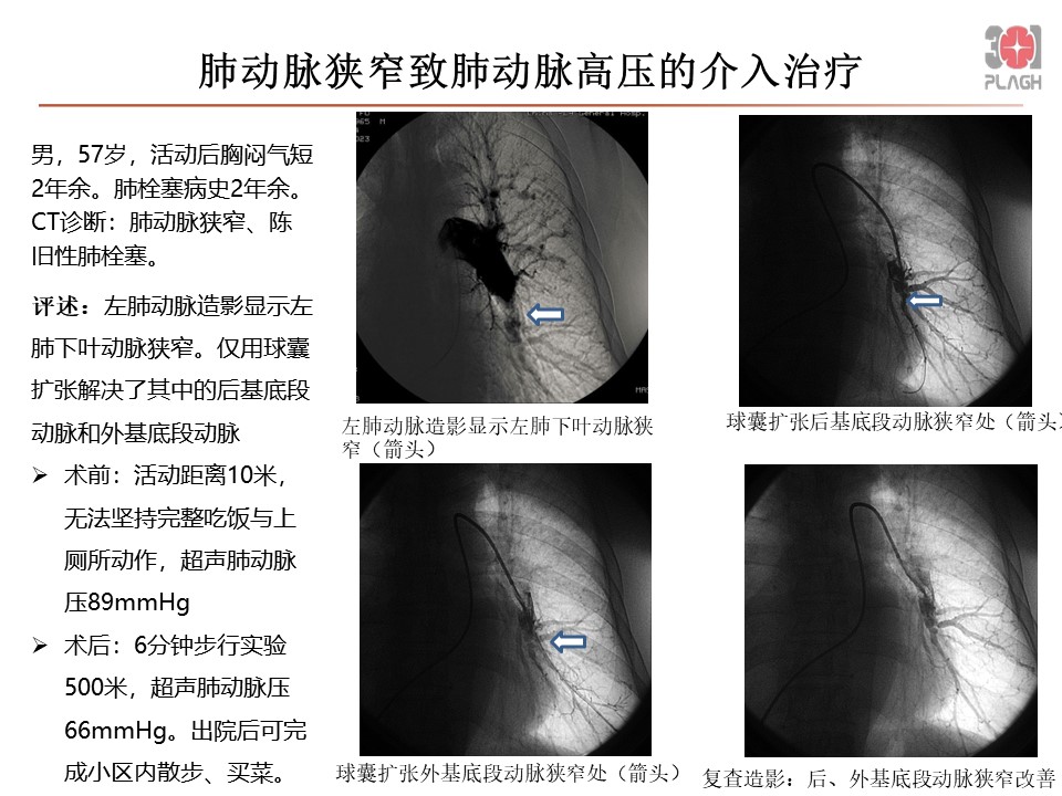 幻灯片5.JPG